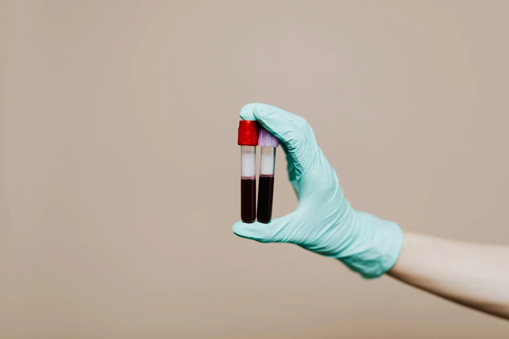 Sistema de Salud en Brasil: Guia para Inmigrantes May 2020